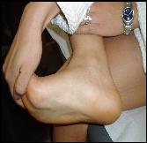 estiramiento-fascia-plantar